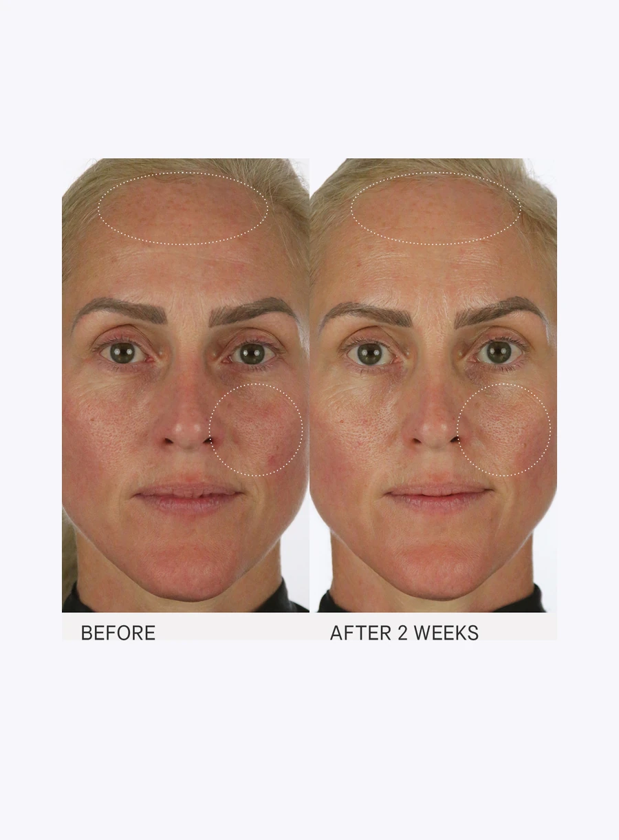 The Milky Sunscreen SPF 50+